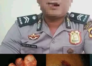 Korban Mengaku Dipersulit, Penanganan Kasus di Polda Gorontalo Menuai Kritik