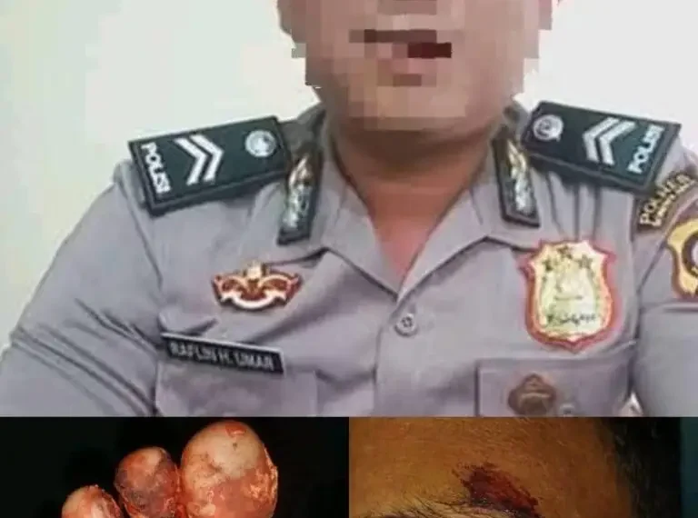 Korban Mengaku Dipersulit, Penanganan Kasus di Polda Gorontalo Menuai Kritik